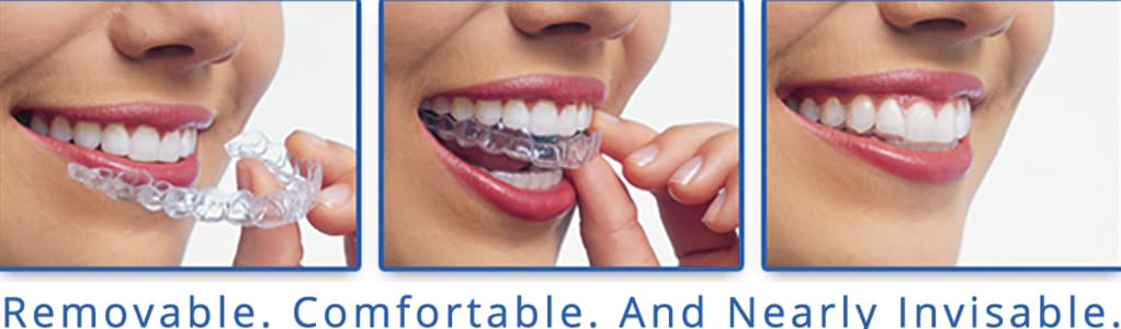 Invisalign, Halifax Dentist